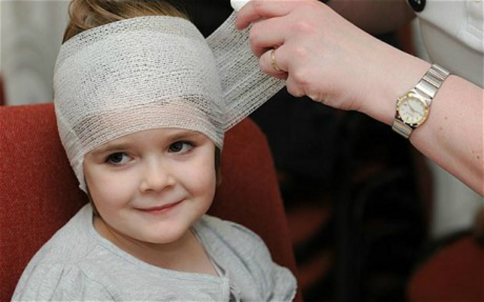 head injury in kids