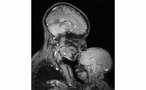 mother-baby-mri