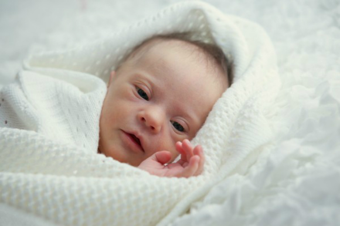 newborn-with-Down-Syndrome-iStock_000025670763-e1423227705332