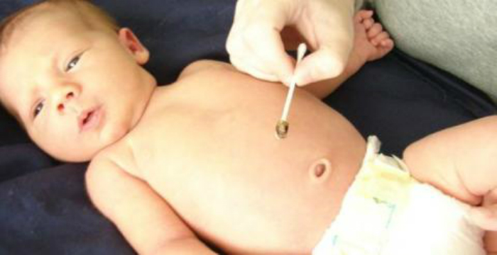 verzorging-navel-van-een-baby