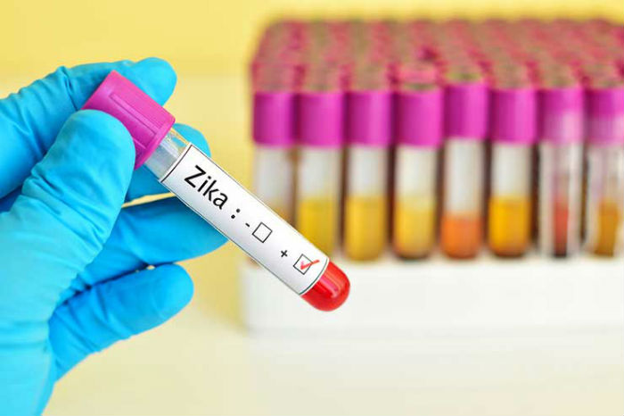 Zika-virus-positive-740